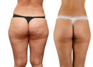 11058419_449252995224232_8147439725697929572_n