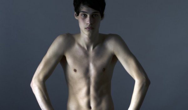 male_anorexia1024