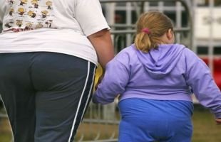 Képtalálat a következőre: „child obesitas”